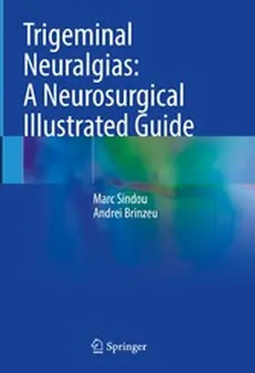 Sindou / Brinzeu |  Trigeminal Neuralgias: A Neurosurgical Illustrated Guide | eBook | Sack Fachmedien