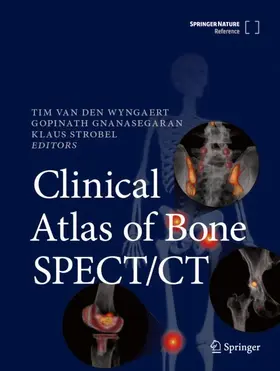 Van den Wyngaert / Strobel / Gnanasegaran |  Clinical Atlas of Bone SPECT/CT | Buch |  Sack Fachmedien