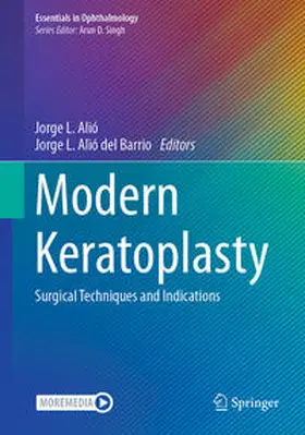 del Barrio / Alió |  Modern Keratoplasty | Buch |  Sack Fachmedien