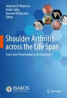 Mazzocca / Calvo / Di Giacomo |  Shoulder Arthritis across the Life Span | eBook | Sack Fachmedien