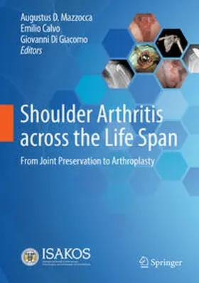 Mazzocca / Calvo / Di Giacomo |  Shoulder Arthritis across the Life Span | Buch |  Sack Fachmedien