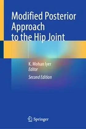 Iyer | Modified Posterior Approach to the Hip Joint | E-Book | www2.sack.de