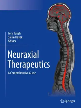 Hayek / Yaksh |  Neuraxial Therapeutics | Buch |  Sack Fachmedien