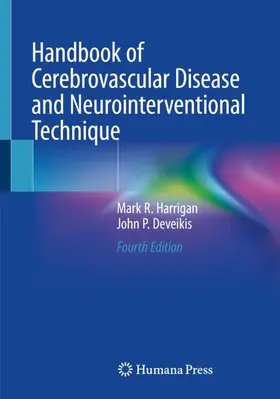 Deveikis / Harrigan |  Handbook of Cerebrovascular Disease and Neurointerventional Technique | Buch |  Sack Fachmedien