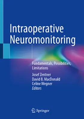 Zentner / MacDonald / Wegner |  Intraoperative Neuromonitoring | eBook | Sack Fachmedien