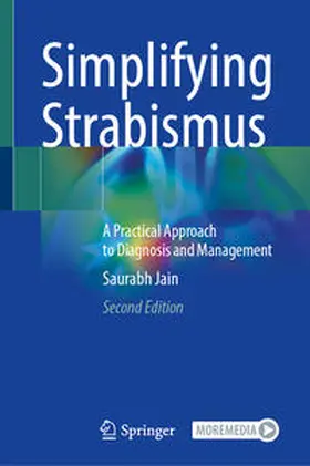 Jain |  Simplifying Strabismus | Buch |  Sack Fachmedien