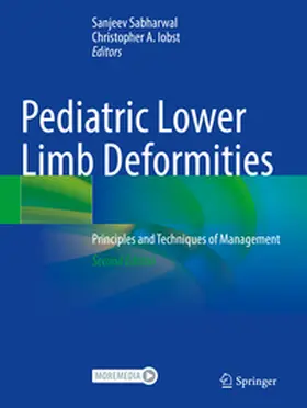 Sabharwal / Iobst |  Pediatric Lower Limb Deformities | Buch |  Sack Fachmedien
