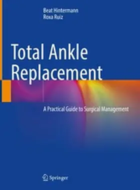 Hintermann / Ruiz |  Total Ankle Replacement | eBook | Sack Fachmedien