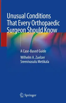 Metikala / Zuelzer | Unusual Conditions That Every Orthopaedic Surgeon Should Know | Buch | 978-3-031-58945-4 | sack.de