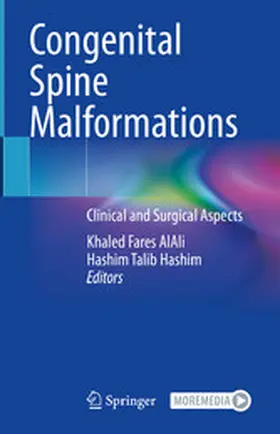 AlAli / Hashim |  Congenital Spine Malformations | eBook | Sack Fachmedien