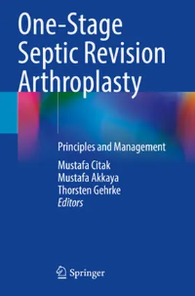Citak / Akkaya / Gehrke |  One-Stage Septic Revision Arthroplasty | Buch |  Sack Fachmedien