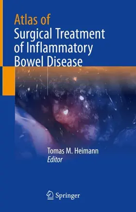 Heimann |  Atlas of Surgical Treatment of Inflammatory Bowel Disease | Buch |  Sack Fachmedien