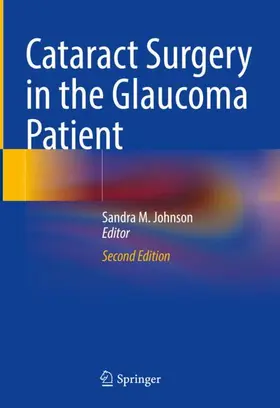 Johnson |  Cataract Surgery in the Glaucoma Patient | Buch |  Sack Fachmedien
