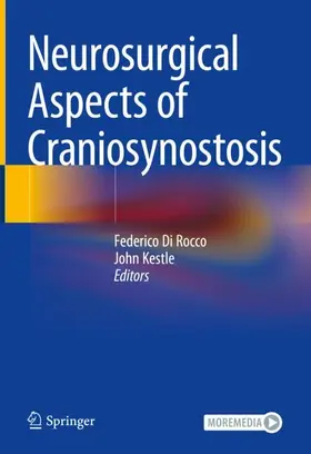 Kestle / Di Rocco |  Neurosurgical Aspects of Craniosynostosis | Buch |  Sack Fachmedien