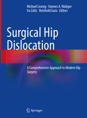 Leunig / Rüdiger / Zaltz |  Surgical Hip Dislocation | eBook | Sack Fachmedien
