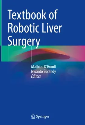 Sucandy / D'Hondt |  Textbook of Robotic Liver Surgery | Buch |  Sack Fachmedien