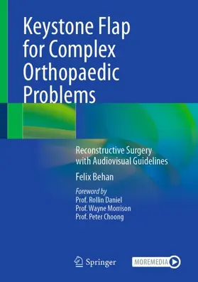 Behan |  Keystone Flap for Complex Orthopaedic Problems | Buch |  Sack Fachmedien