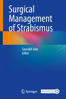 Jain |  Surgical Management of Strabismus | eBook | Sack Fachmedien
