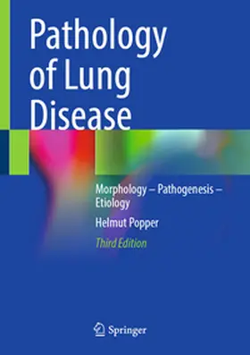Popper |  Pathology of Lung Disease | eBook | Sack Fachmedien