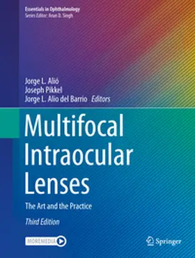 Alió / Pikkel / Alió del Barrio |  Multifocal Intraocular Lenses | eBook | Sack Fachmedien