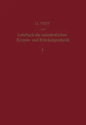 VEST |  Lehrbuch der Zahnärztlichen Kronen- und Brückenprothetik | Buch |  Sack Fachmedien