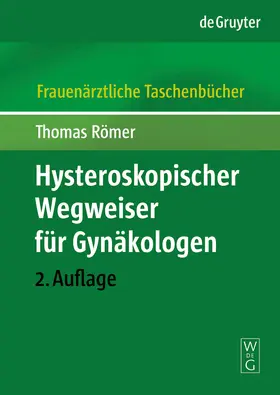 Römer |  Hysteroskopischer Wegweiser für Gynäkologen | Buch |  Sack Fachmedien