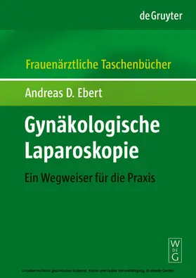 Ebert |  Gynäkologische Laparoskopie FATB | eBook | Sack Fachmedien