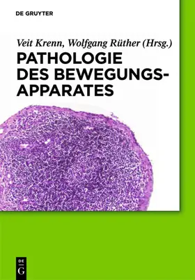 Krenn / Rüther |  Pathologie des Bewegungsapparates | eBook | Sack Fachmedien