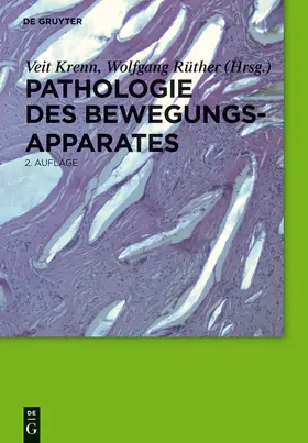 Krenn / Rüther |  Pathologie des Bewegungsapparates | Buch |  Sack Fachmedien