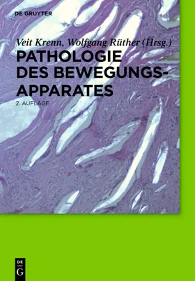 Krenn / Rüther |  Pathologie des Bewegungsapparates | eBook | Sack Fachmedien