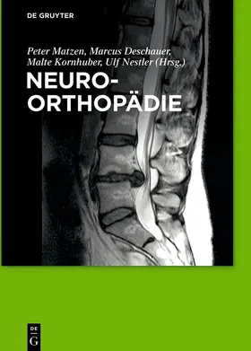 Nestler / Matzen / Kornhuber |  Neuroorthopädie | Buch |  Sack Fachmedien