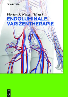 Netzer |  Endoluminale Varizentherapie | Buch |  Sack Fachmedien