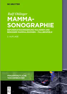 Ohlinger |  Mammasonographie | eBook | Sack Fachmedien