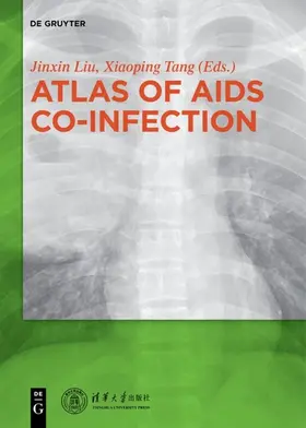 Jinxin / Xiaoping |  Atlas of AIDS Co-infection | eBook | Sack Fachmedien