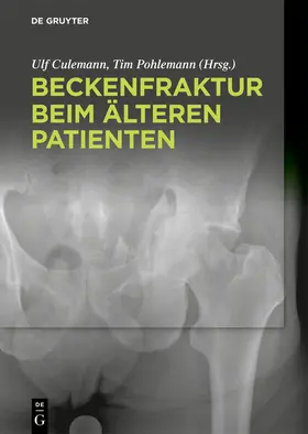 Pohlemann / Culemann |  Beckenfraktur beim älteren Patienten | Buch |  Sack Fachmedien