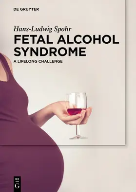 Spohr | Fetal Alcohol Syndrome | E-Book | www2.sack.de