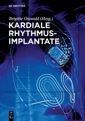 Osswald |  Kardiale Rhythmusimplantate | Buch |  Sack Fachmedien