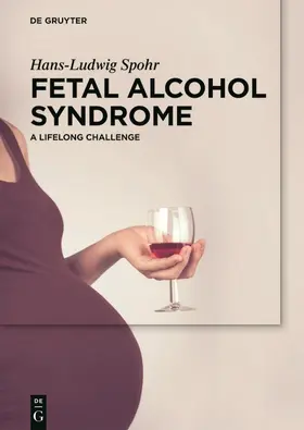 Spohr |  Fetal Alcohol Syndrome | Buch |  Sack Fachmedien