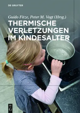 Vogt / Fitze | Thermische Verletzungen im Kindesalter | Buch | 978-3-11-044284-7 | sack.de