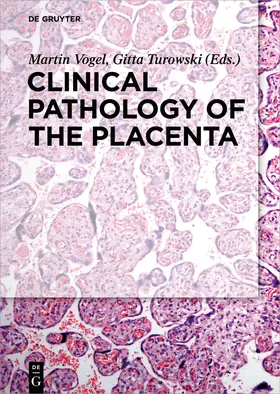 Turowski / Vogel |  Clinical Pathology of the Placenta | Buch |  Sack Fachmedien