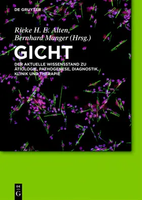 Alten / Manger |  Gicht | eBook | Sack Fachmedien