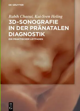 Chaoui / Heling |  3D-Sonografie in der pränatalen Diagnostik | eBook | Sack Fachmedien