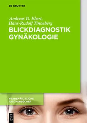 Ebert |  Blickdiagnostik Gynäkologie | Buch |  Sack Fachmedien