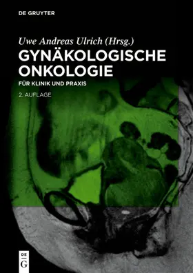 Ulrich |  Gynäkologische Onkologie | eBook | Sack Fachmedien