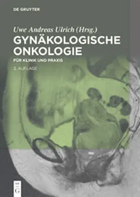 Ulrich |  Gynäkologische Onkologie | eBook | Sack Fachmedien