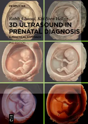 Chaoui / Heling |  3D Ultrasound in Prenatal Diagnosis | eBook | Sack Fachmedien