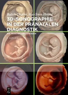 Chaoui / Heling |  3D-Sonographie in der pränatalen Diagnostik | Buch |  Sack Fachmedien