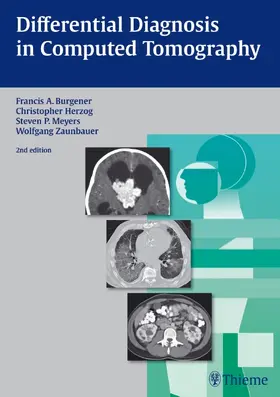 Burgener / Kormano / Herzog |  Differential Diagnosis in Computed Tomography | Buch |  Sack Fachmedien