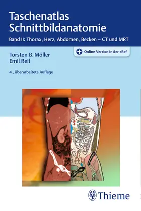 Möller / Reif |  Taschenatlas Schnittbildanatomie 02 | Buch |  Sack Fachmedien