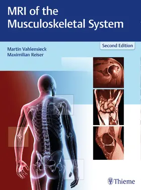 Vahlensieck / Reiser |  MRI of the Musculoskeletal System | Buch |  Sack Fachmedien